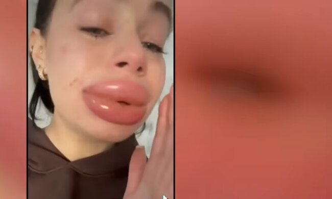 Hyaluronsäure statt Selbstliebe? Quelle: Youtube Screenshot