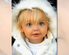 Ein Mädchen wurde mit Puppenaussehen geboren: wie es Jahre später aussieht