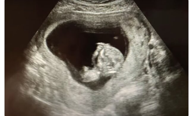 Foto: Youtube Screenshot