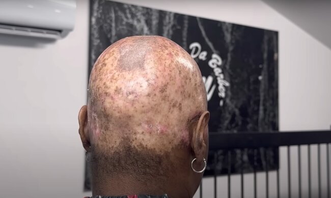 Anna. Quelle: Youtube Screenshot