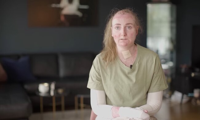 Kampf gegen den Haarausfall. Quelle: Youtube Screenshot