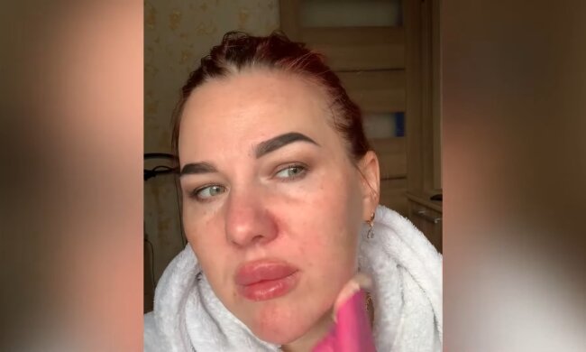 Die Gefahren des DIY-Schönheitswahns. Quelle: Youtube Screenshot