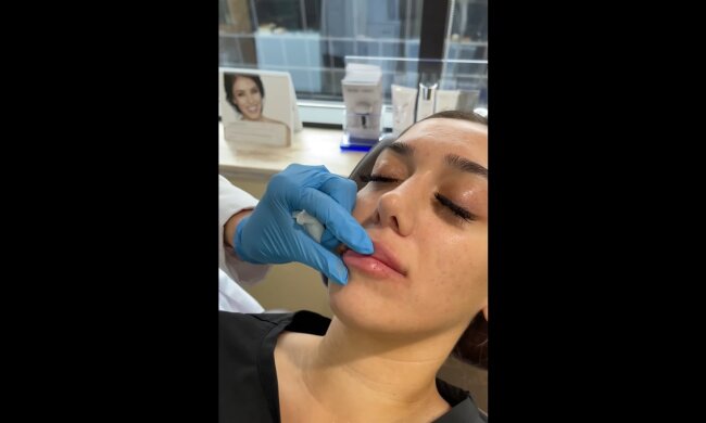 Frau mit den aufgespritzten Lippen. Quelle: Youtube Screenshot