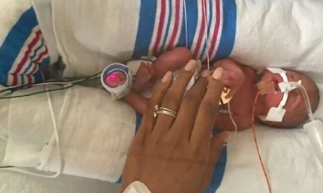 Nachts bedeckte die Mutter ihr frühgeborenes Kind mit einem Handschuh und rettete es