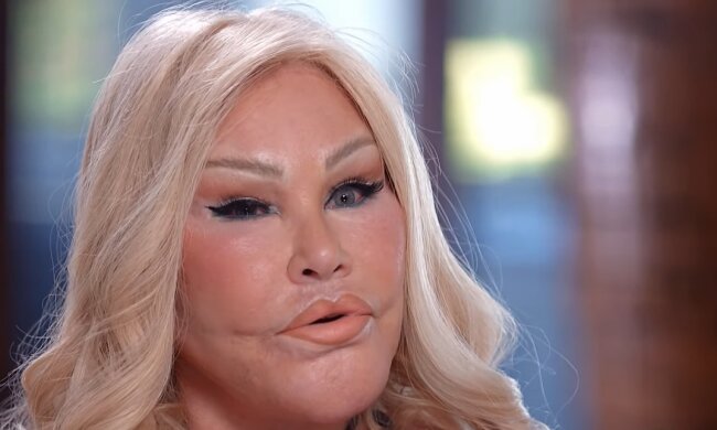 "Bye-bye Catwoman": Berühmte Schönheitschirurgie-Fanatikerin Jocelyn Wildenstein hat im Alter von 84 Jahren die Welt verlassen