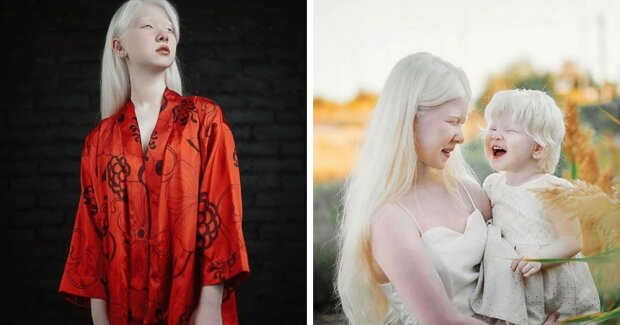 Die Albino-Schwestern wurden im Abstand von 12 Jahren geboren und bekommen mit ihrem fabelhaften Aussehen die Aufmerksamkeit der Modewelt