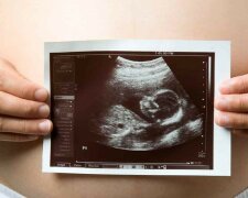 Berührende Einheitlichkeit: Ein Arzt sah die zarten Küsse der Zwillinge auf einem Ultraschallbild