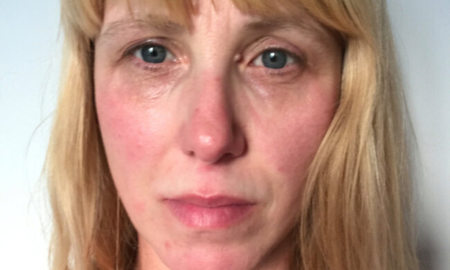Die Mutter von drei Kindern zeihte, wie 36 Stunden ohne Schlaf ihr Aussehen beeinflussten