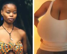Wie sich das Leben eines Mädchens mit 13 Brustgröße nach der Verkleinerung verändert hat