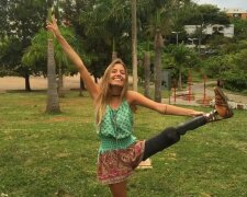 Das brasilianische Modell hat ihr Bein verloren, zeigt aber, dass sich sein Leben keineswegs verändert hat