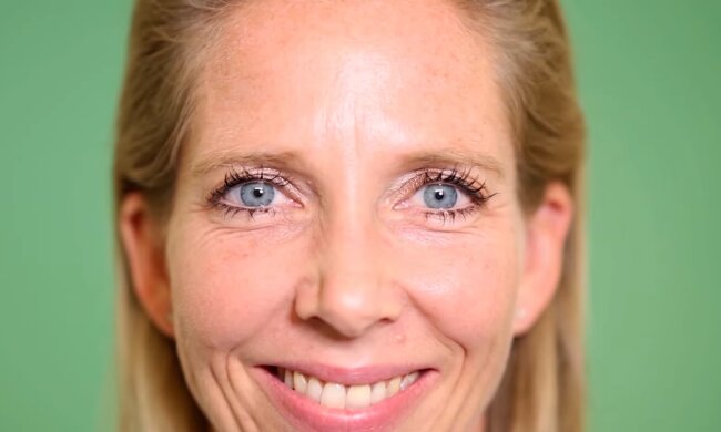 Botox, Hyaluron und Co. Quelle: Youtube Screenshot
