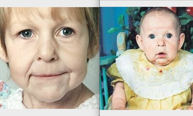 Junge Frau sah mit 16 Hahren so aus, als ob sie 50 wäre: wie sie jetzt im Alter von 25 Jahren lebt