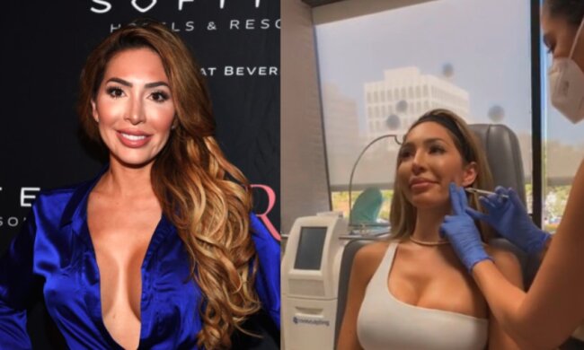 “Schönheitsspritzen”: Eine berühmte Mutter nahm ihre elfjährige Tochter zur Verjüngung mit