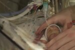 Babymädchen kommt in der 23. Woche zur Welt und beweist im Inkubator täglich ihren unglaublichen Lebenswillen