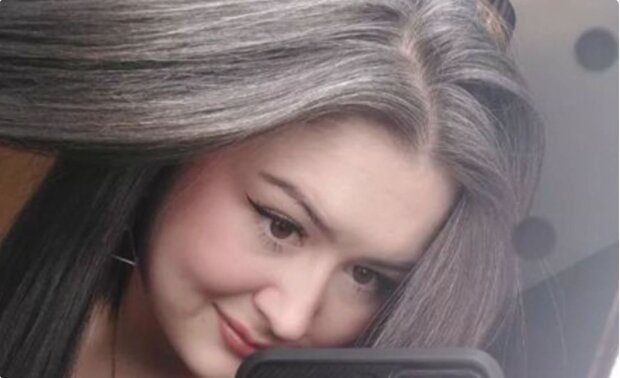 Eine junge Frau, die mit 25 Jahren grau wurde, fühlt sich "selbstbewusster", nachdem sie ihr Haar so akzeptiert hat, wie es ist