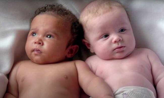 Frau bringt Zwillinge von verschiedenen Vätern zur Welt: Das passiert einmal in einer Million Fällen