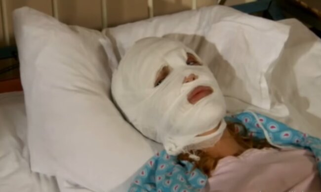 Ehefrau unterzieht sich einer Schönheitsoperation, um ihren Mann zu beeindrucken: er reicht die Scheidung ein