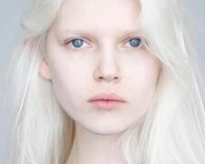 Weißer als Schnee: Wie sehen Albinos aus der ganzen Welt aus