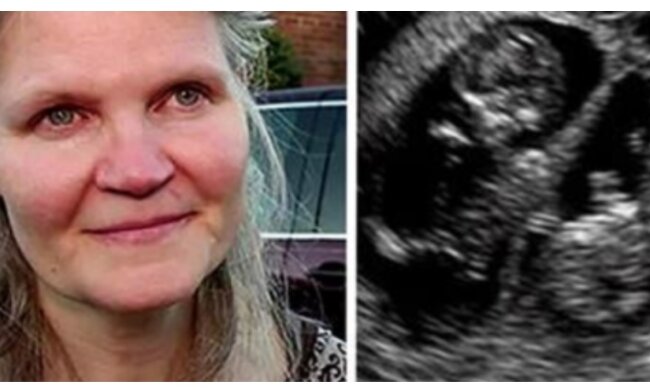 Unerwartete Schwangerschaft.  Quelle: mimimetr.сom