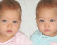 “Engelsschönheit”: Im Alter von 7 Jahren wurden die Mädchen als die schönsten Zwillinge der Welt anerkannt