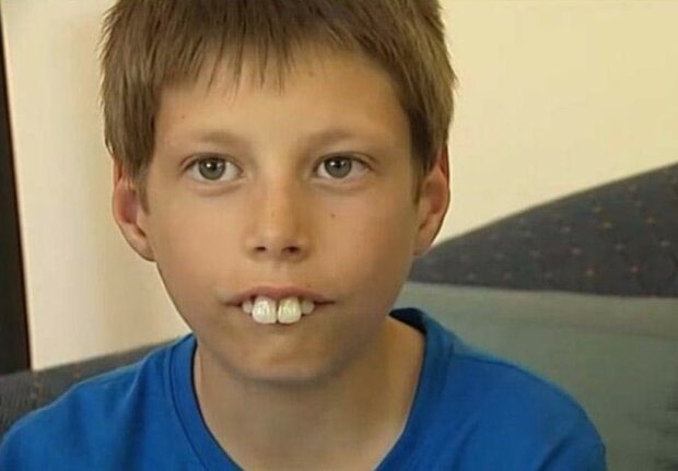 Wie sieht jetzt ein Teenager aus, der die größten Zähne der Welt hatte