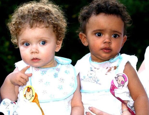 Zwillinge mit unterschiedlichen Hautfarben wurden vor 13 Jahren geboren: Wie sie heute aussehen