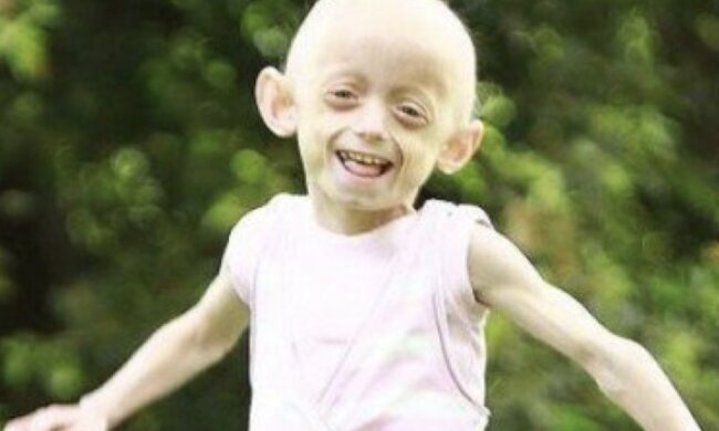 Ashanti, ein siebenjähriges Mädchen. Quelle: www. billionnews.сom