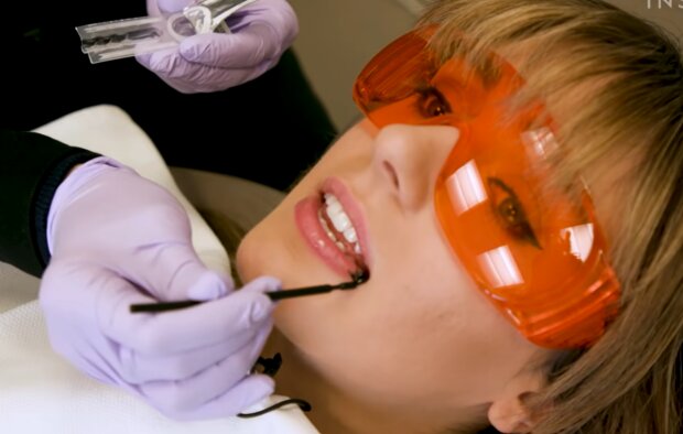 Eine Frau wollte unbedingt weiße Zähne bekommen: das Ergebnis hat sie nicht zufrieden gestellt