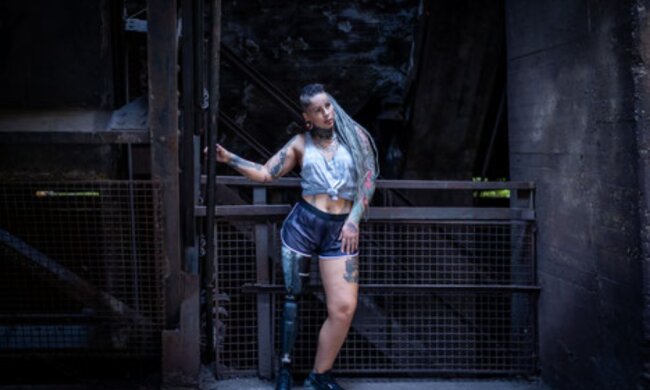 Eine junge Frau aus Deutschland beschloss, ihr Bein loszuwerden, das sie nicht mochte, und begann ein neues Leben