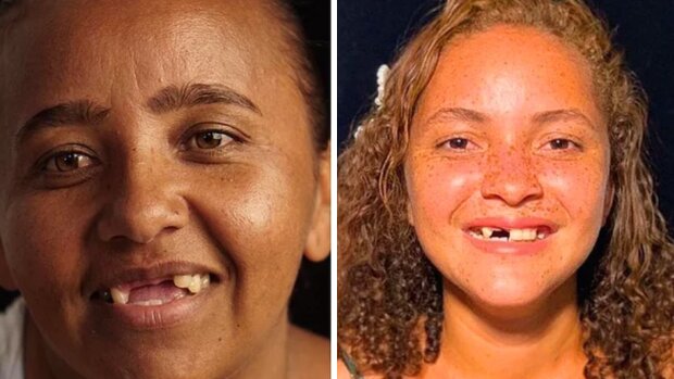 Frauen ohne Zähne. Quelle: screenshot