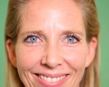 Botox, Hyaluron und Co. Quelle: Youtube Screenshot