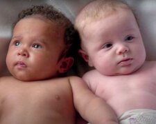 Frau bringt Zwillinge von verschiedenen Vätern zur Welt: Das passiert einmal in einer Million Fällen