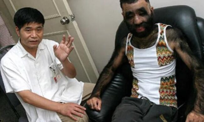 Wie der behaarteste Mann der Welt aussieht und was er macht