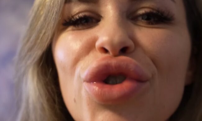 Lippenvergrößerung statt Selbstzweifel. Quelle: Youtube Screenshot
