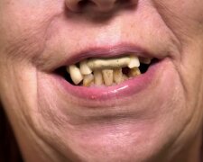 Die Trennung von der Zahnhygiene. Quelle: Youtube Screenshot