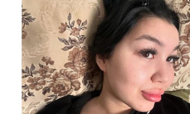 „Kein Make-up nötig: Ich erhalte jeden Tag Komplimente für mein Aussehen“