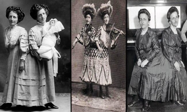 Wie die siamesischen Zwillinge ihre Ehemänner teilten: die Geschichte der Schwestern der Familie Blazek