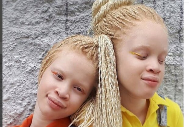 Albino-Zwillinge Lara und Mara. Quelle: Screenshot Youtube