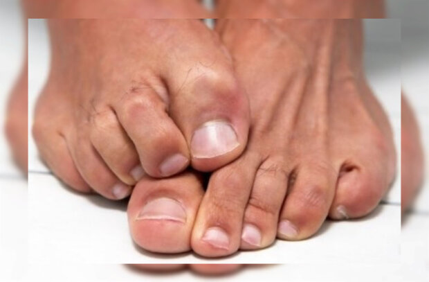Mann will sich die Fußnägel nicht schneiden. Quelle: Screenshot Youtube