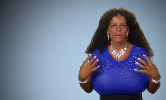 Der Traum von der perfekten Nase. Quelle: Youtube Screenshot