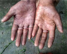 Finger ohne Abdrücke: Wie Menschen leben, die schwer zu finden sind