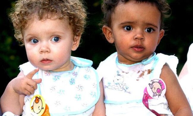 Zwillinge mit unterschiedlichen Hautfarben wurden vor 13 Jahren geboren: Wie sie heute aussehen