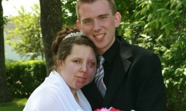 Die junge Frau dachte, dass niemand sie wegen des riesigen Muttermals lieben oder heiraten würde, aber sie irrte sich