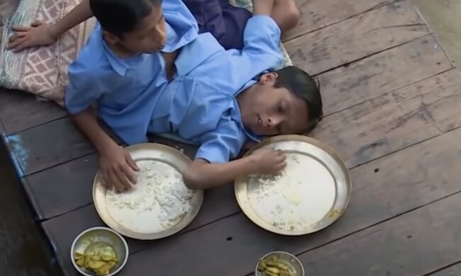 Siamesische Zwillinge. Quelle: Screenshot YouTUbe