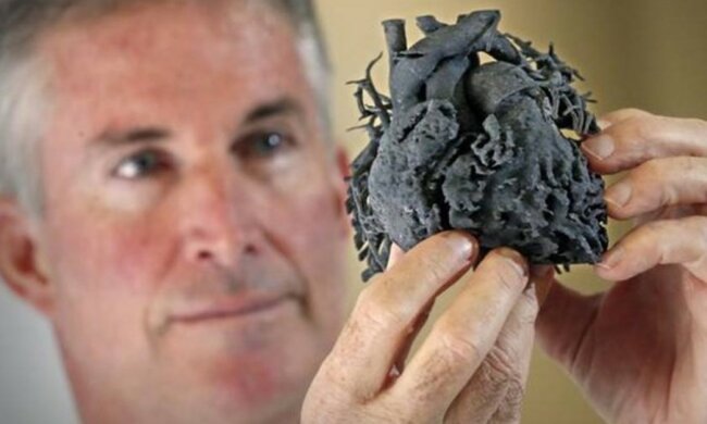 Die Ärzte druckten ein 3D-Herz aus, um ein 4-jähriges Baby zu retten