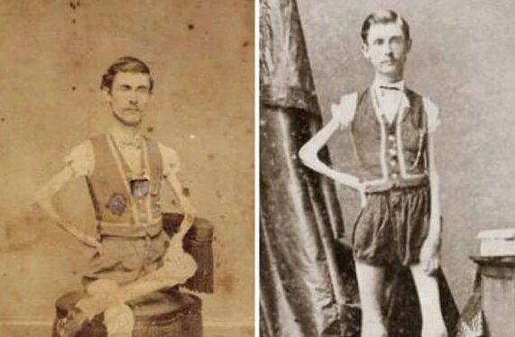 Die Geschichte des Zirkuskünstlers Isaac Sprague, der im neunzehnten Jahrhundert als der dünnste Mann galt
