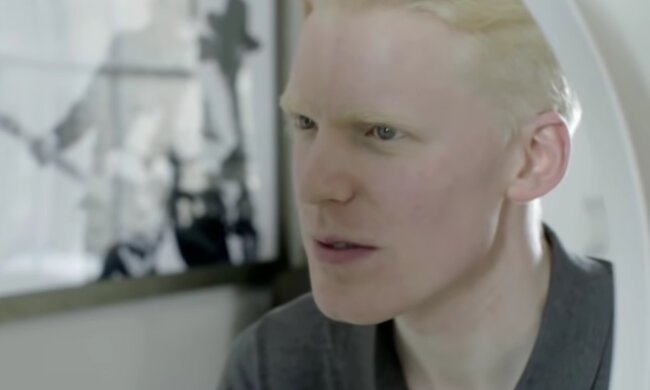 Albinismus ist eine seltene natürliche Anomalie. Quelle: Screenshot YouTube