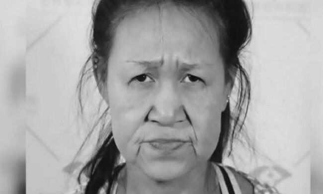 Dies ist keine alte Frau. Sie ist erst 15 Jahre alt und hat eine seltene Krankheit. Aber das Mädchen wurde operiert und jetzt ist sie eine Schönheit (Fotos, Video)