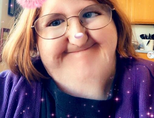 Wie besondere Melissa Blake lebt: eine Frau mit Freeman Sheldon-Syndrom