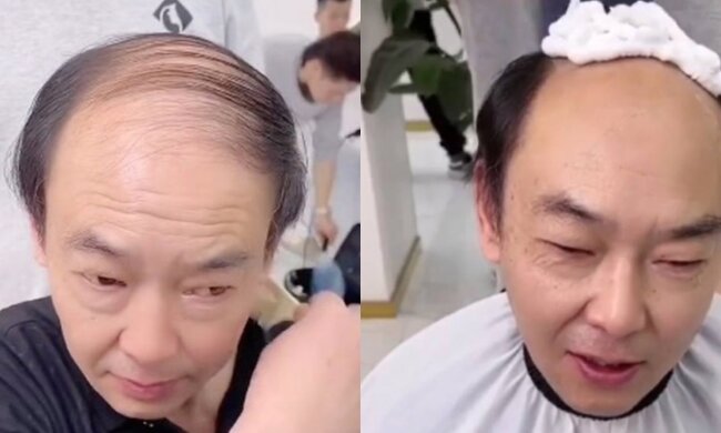 Kahlköpfiger Mann. Quelle: Screenshot